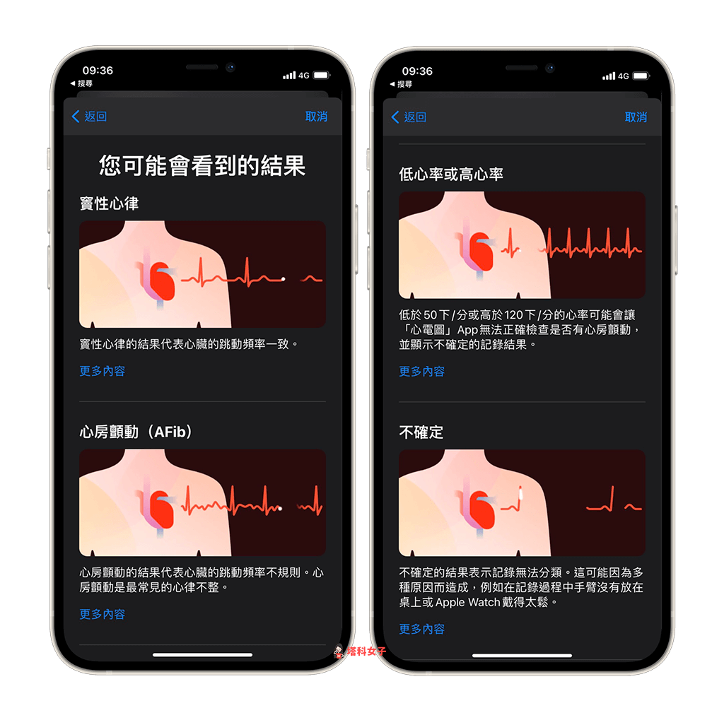 Apple Watch 心電圖：健康 App 首次啟用