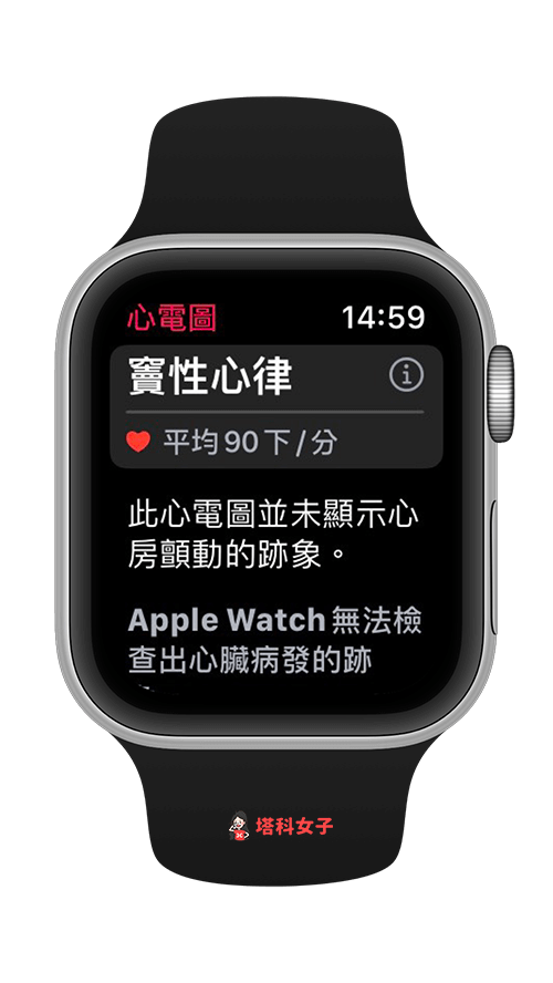 Apple Watch 心電圖：查看檢查結果
